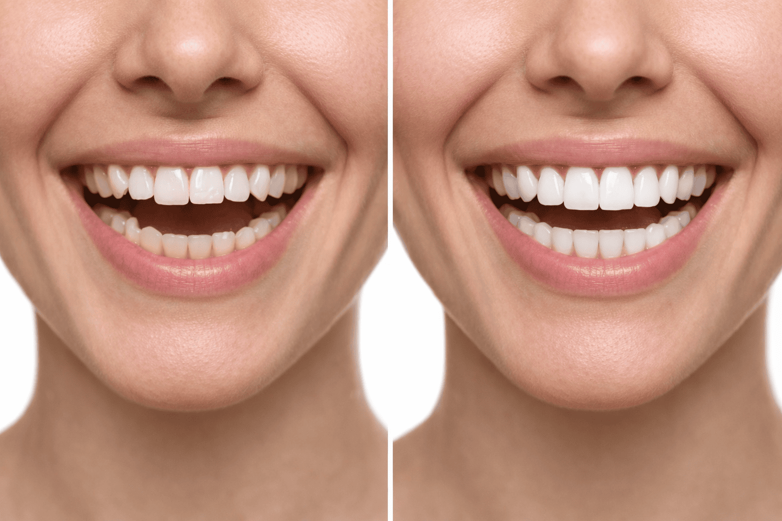 Cabine blanchiment dentaire Autrement Belle