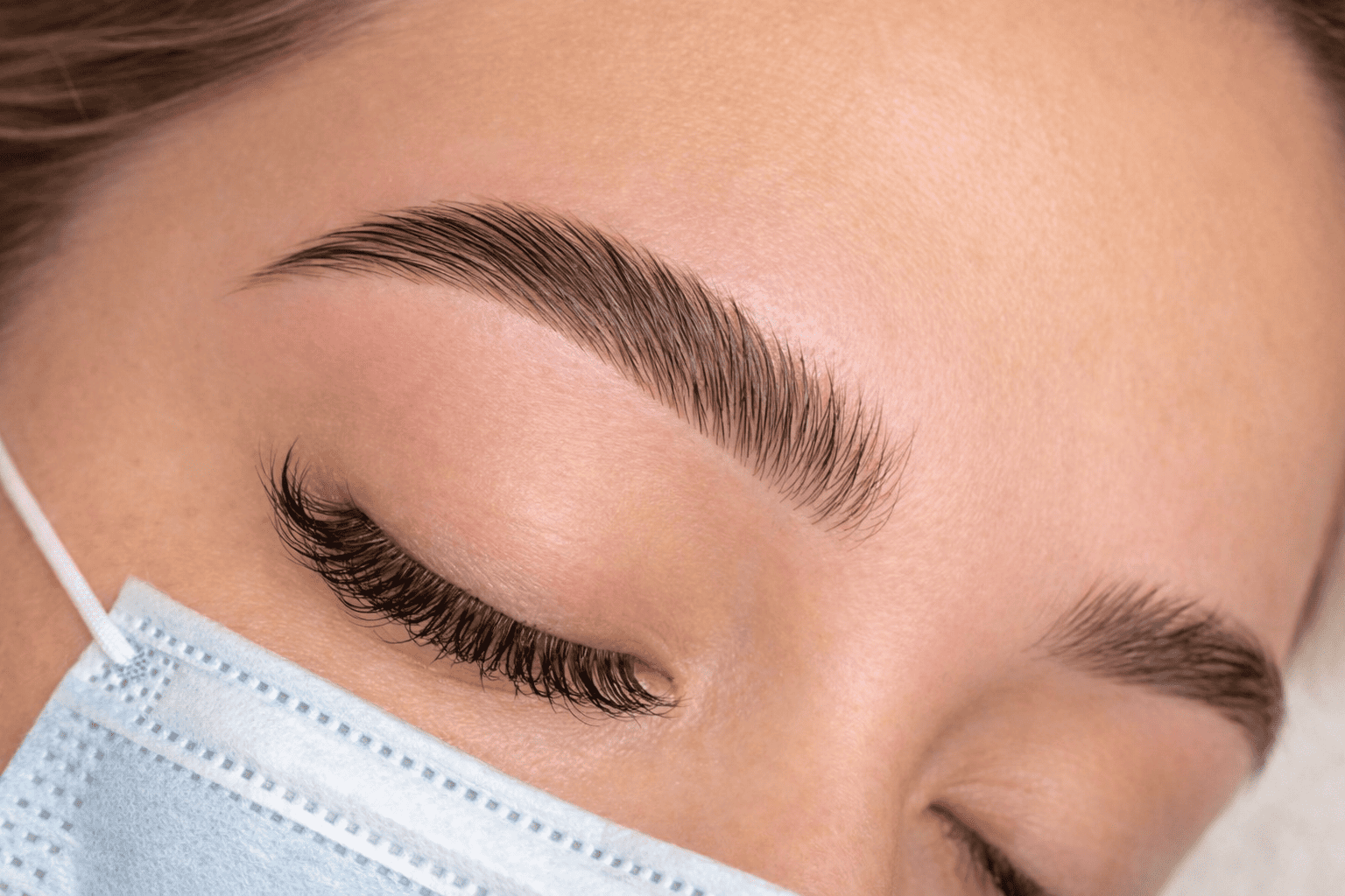 Résultat browlift regard harmonieux