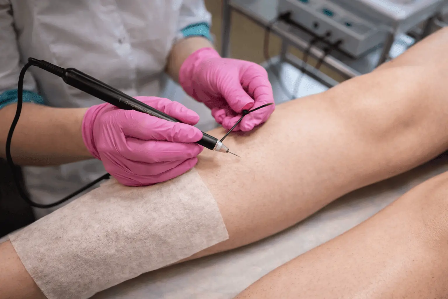 Institut premium pour epilation electrolyse proche de Poitiers