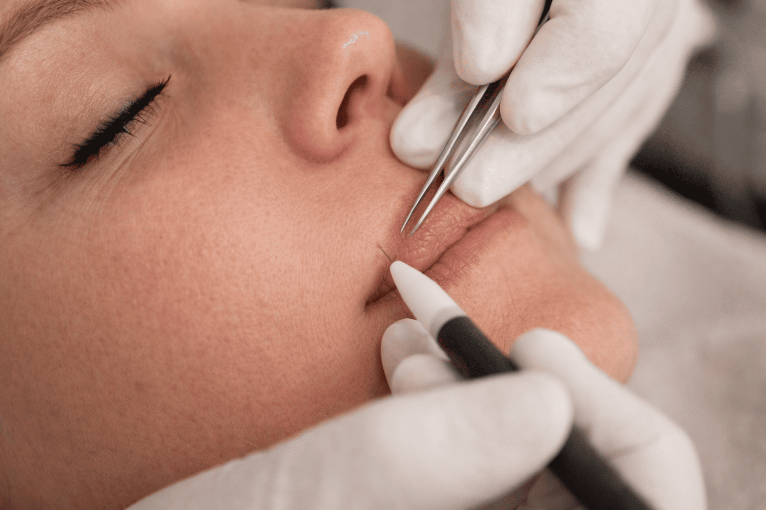 Accompagnement epilation electrolyse à Buxerolles