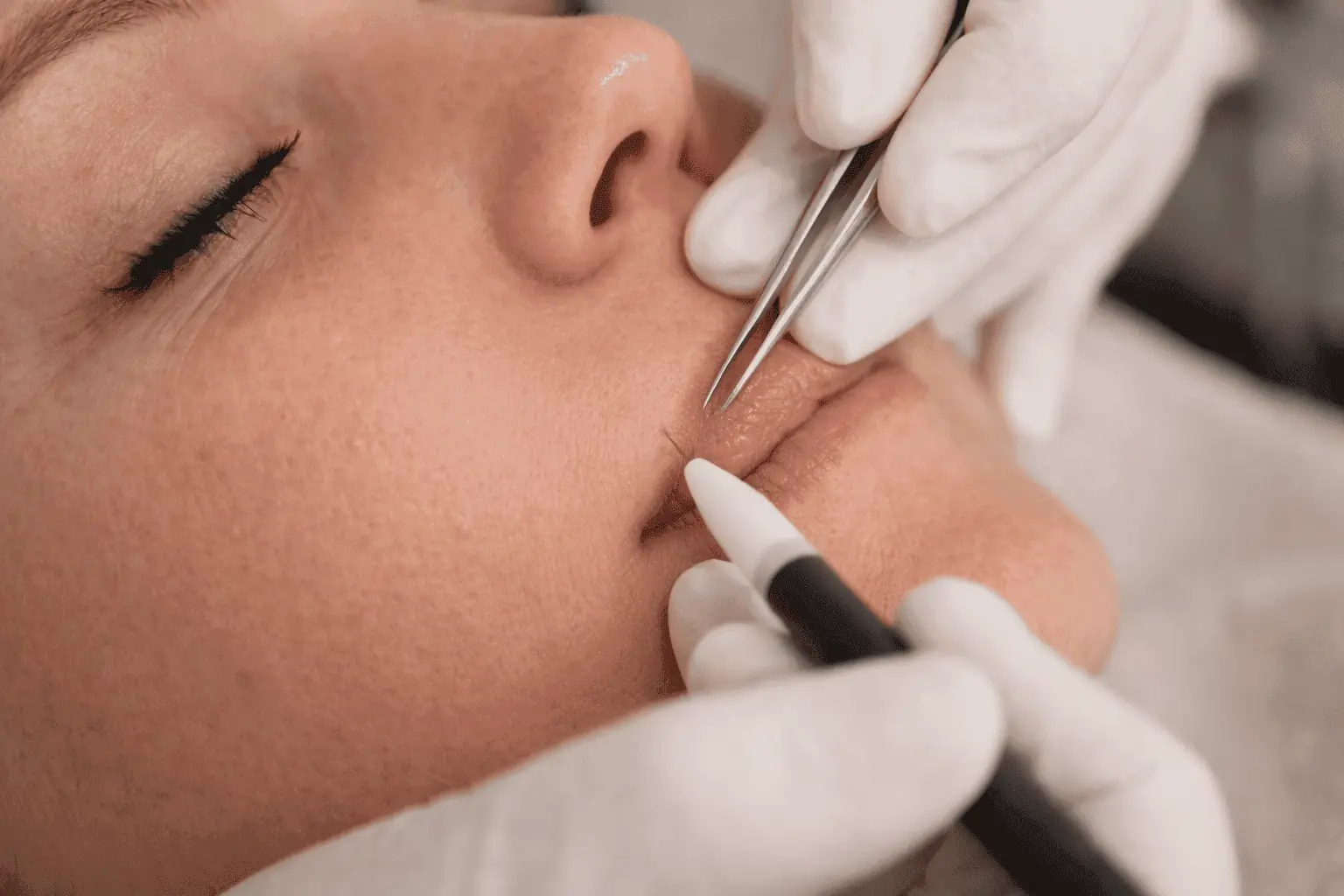 Accompagnement epilation electrolyse à Buxerolles