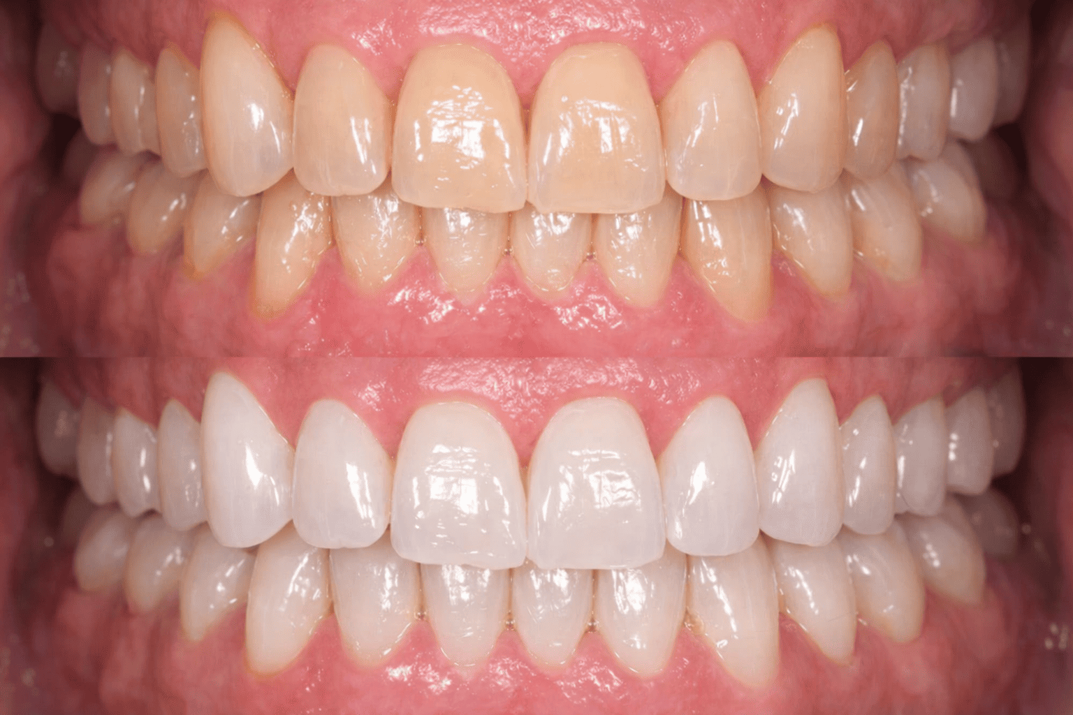 Accompagnement sourire esthétique à Buxerolles