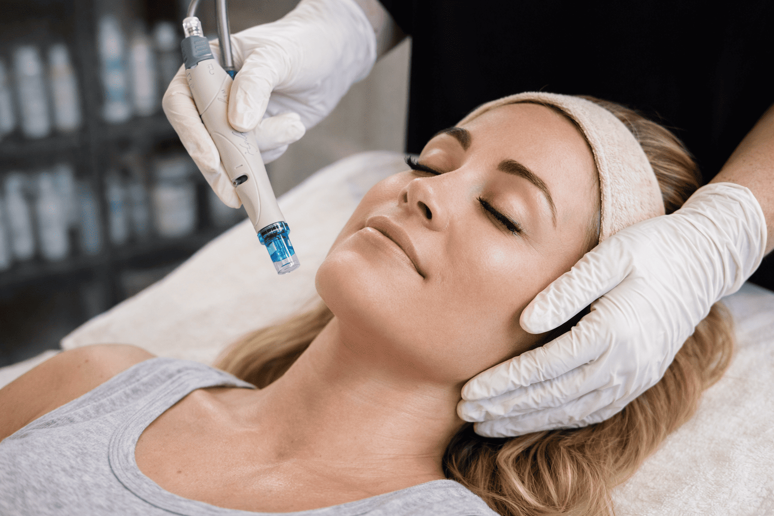 Resultat peau lumineuse apres hydrofacial Poitiers